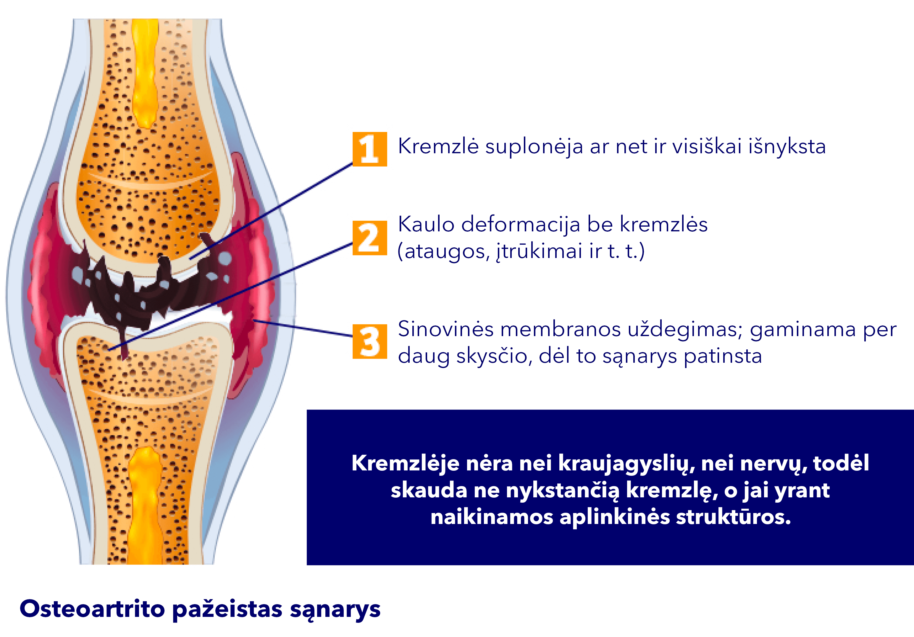 articulation avec de l'arthrose